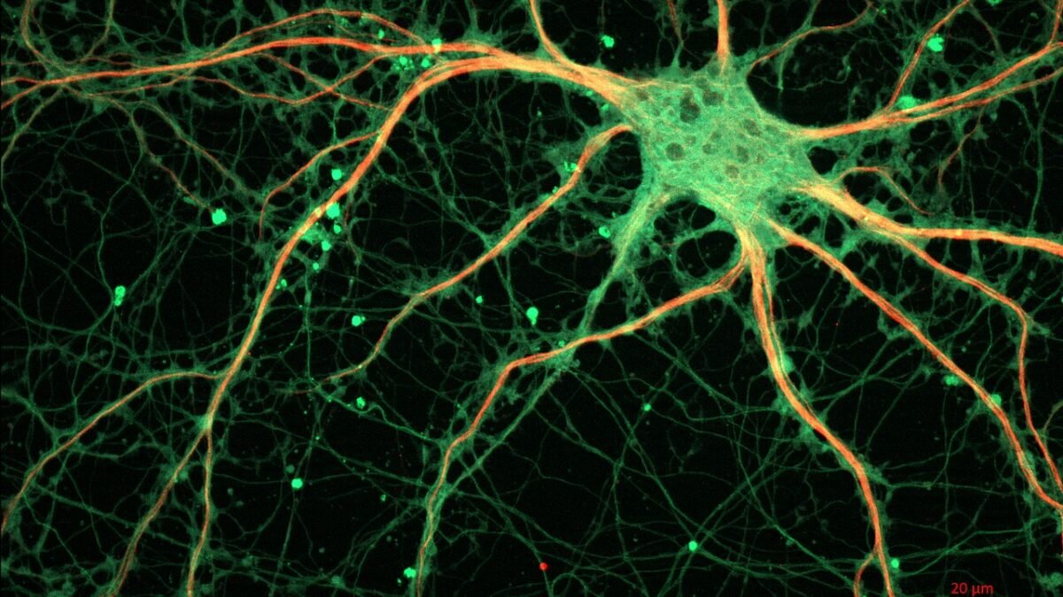 Neurone d'hippocampe en culture, vu au microscope à fluorescence