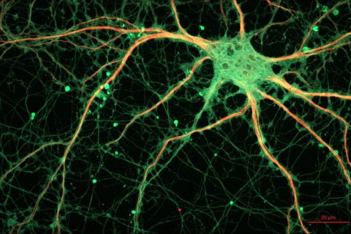 Neurone d'hippocampe en culture, vu au microscope à fluorescence
