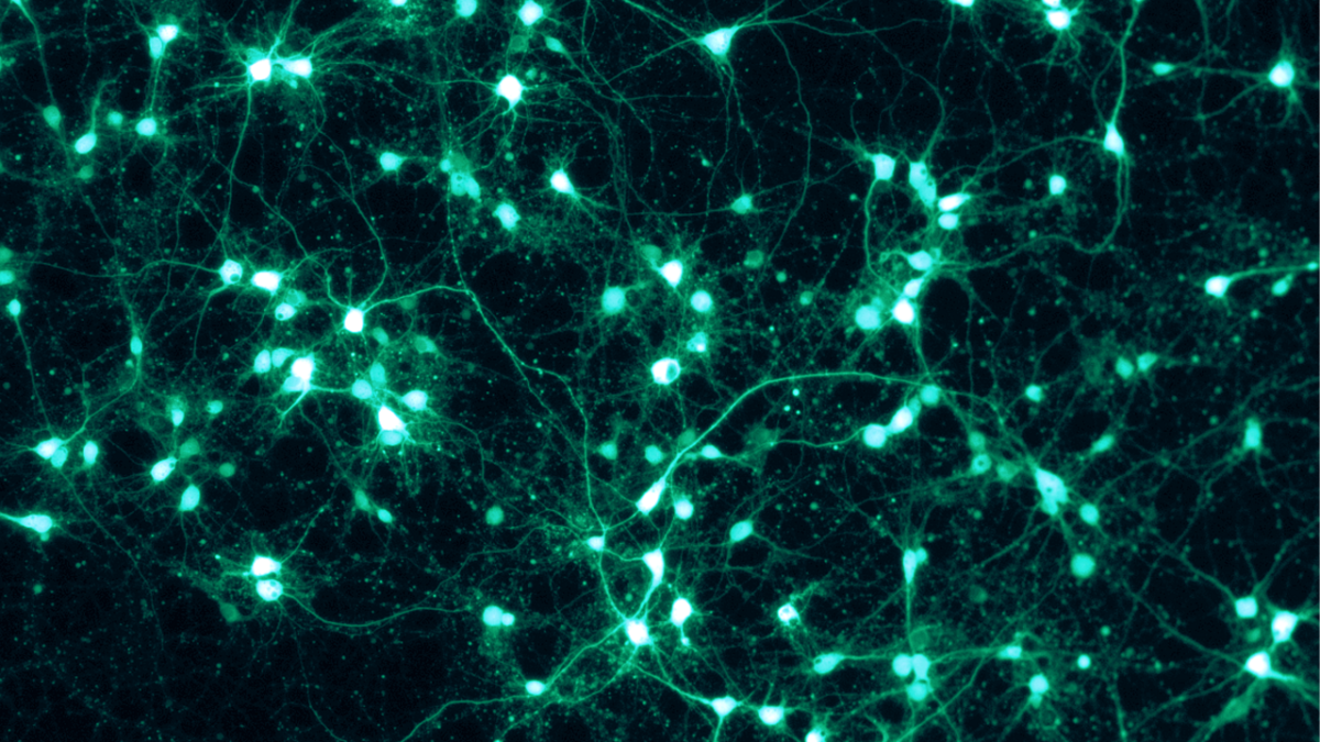 Réseau de neurones en culture, fluorescence verte sur fond sombre