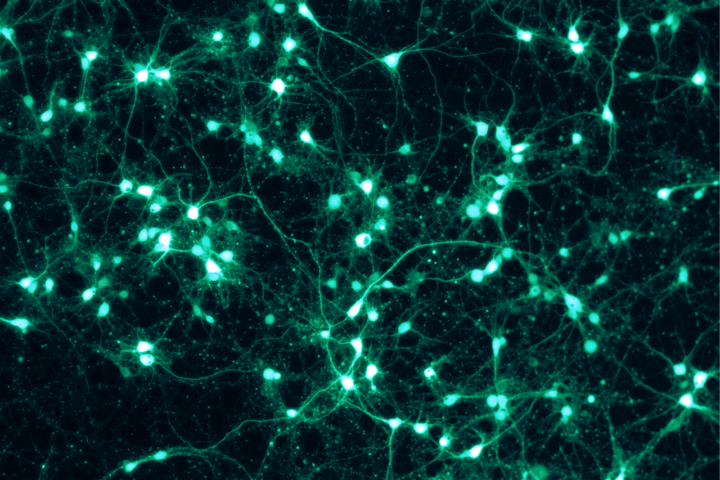 Réseau de neurones en culture, fluorescence verte sur fond sombre